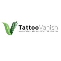Tattoo Vanish