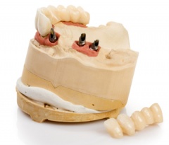 Affordable Dental Solutions 